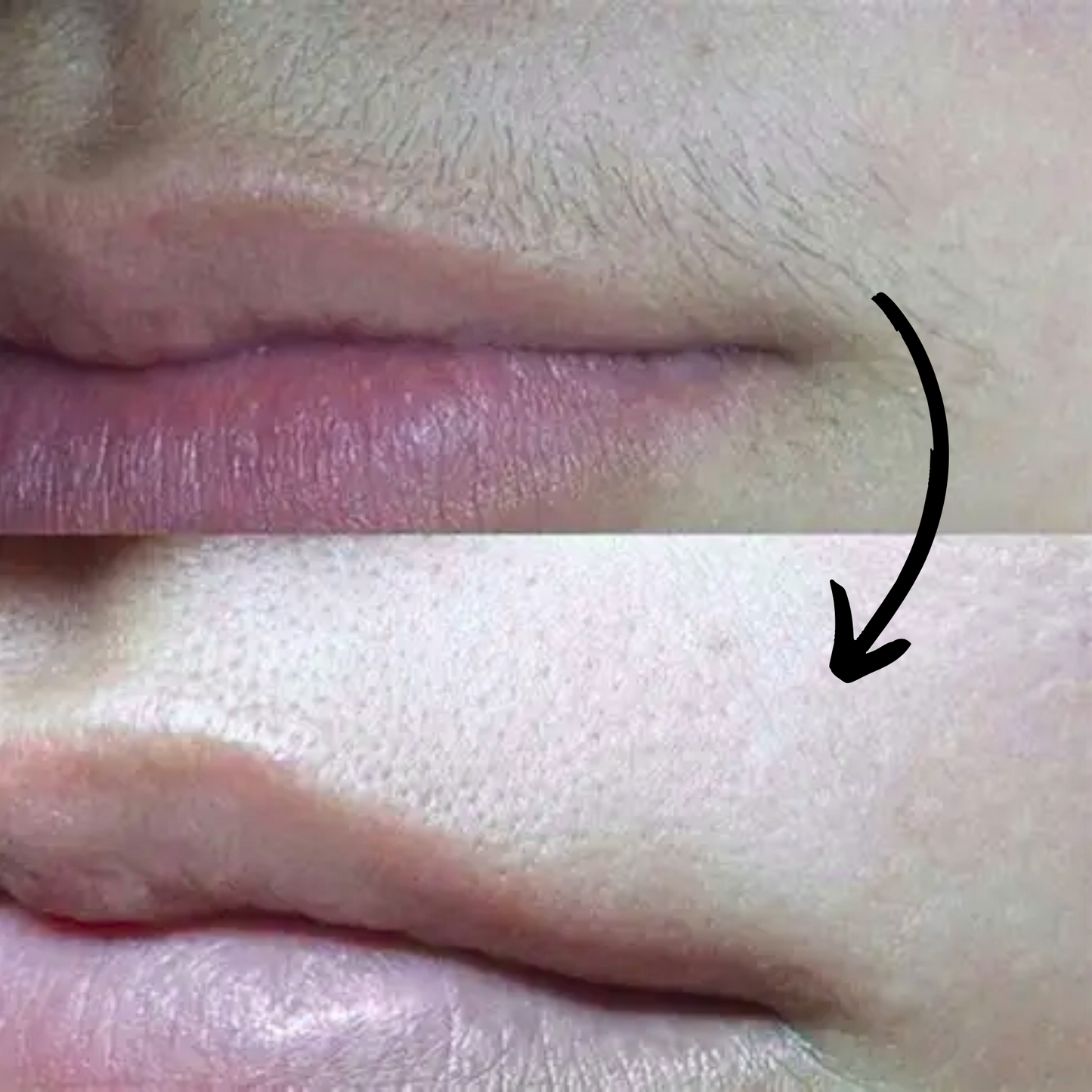 Depilador Facial Recargable - Cuppingo™